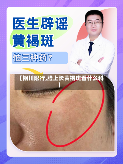 【钢川限行,脸上长黄褐斑看什么科】-第2张图片