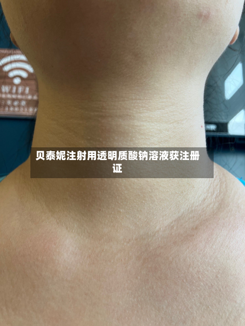 贝泰妮注射用透明质酸钠溶液获注册证-第2张图片